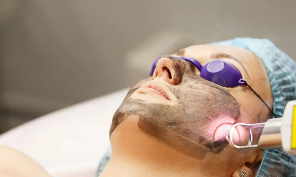 Rejuvenescimento facial com luz pulsada